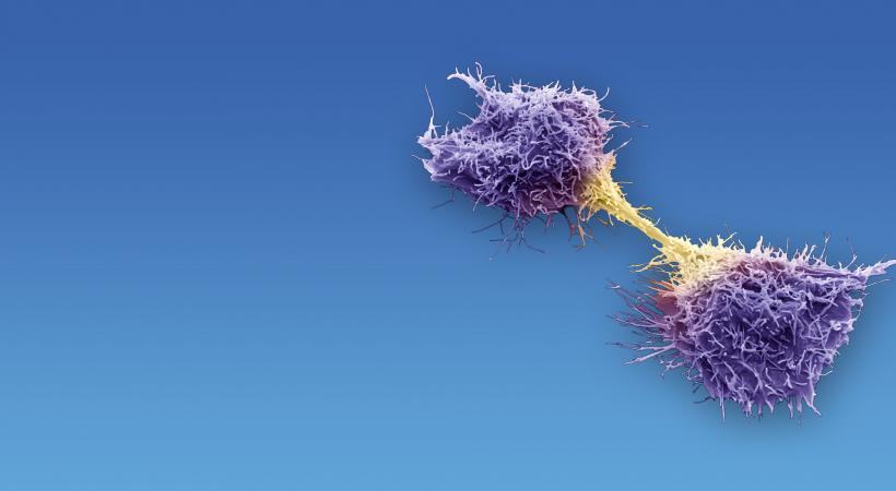 La molécule développée permet de conduire à la mort des cellules cancéreuses. EPFL